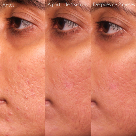 Caudalie Vinopure Sérum con Acido Salicílico Anti-imperfecciones